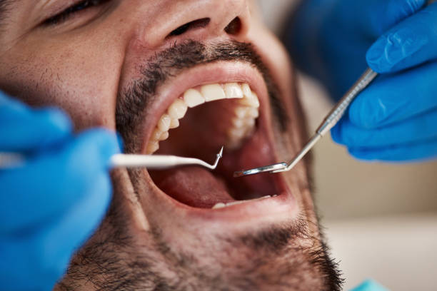 Best Pediatric Emergency Dentist in Lake Camelot, IL