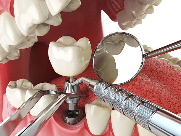 Best Emergency Treatment for Toothache in Lake Camelot, IL